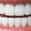 s4_53f0bdef08d59-1.jpg DENTIFRICE FOREVER BRIGHT TOOTHGEL (gel dentaire )