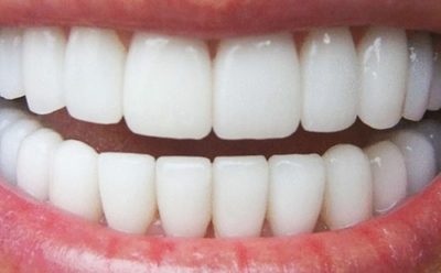 s4_53f0bdef08d59-1.jpg DENTIFRICE FOREVER BRIGHT TOOTHGEL (gel dentaire )